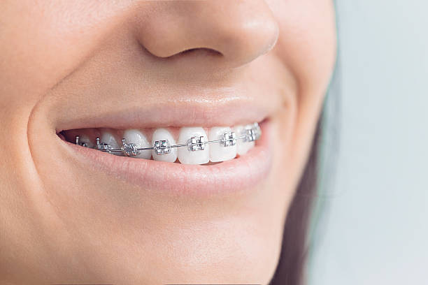 Best Teeth Whitening  in Heflin, AL